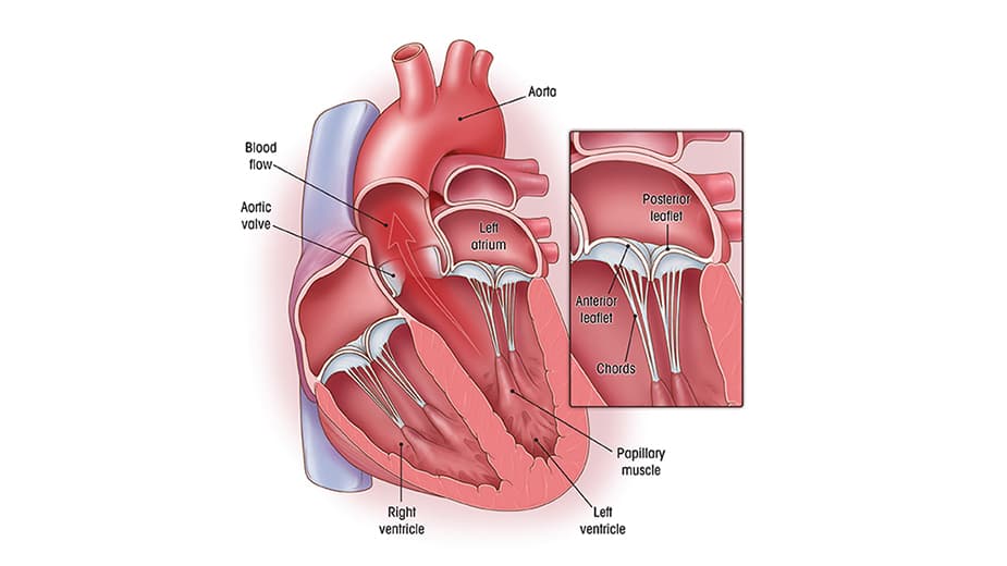 Minimally Invasive Mitral Valve Repair 8139